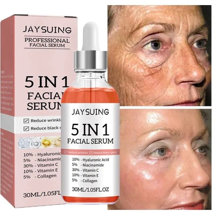 Before and after results using a hydrating serum for dry skin with vitamin C, showing reduced wrinkles and dark spots with Jaysuing 5-in-1 Facial Serum.